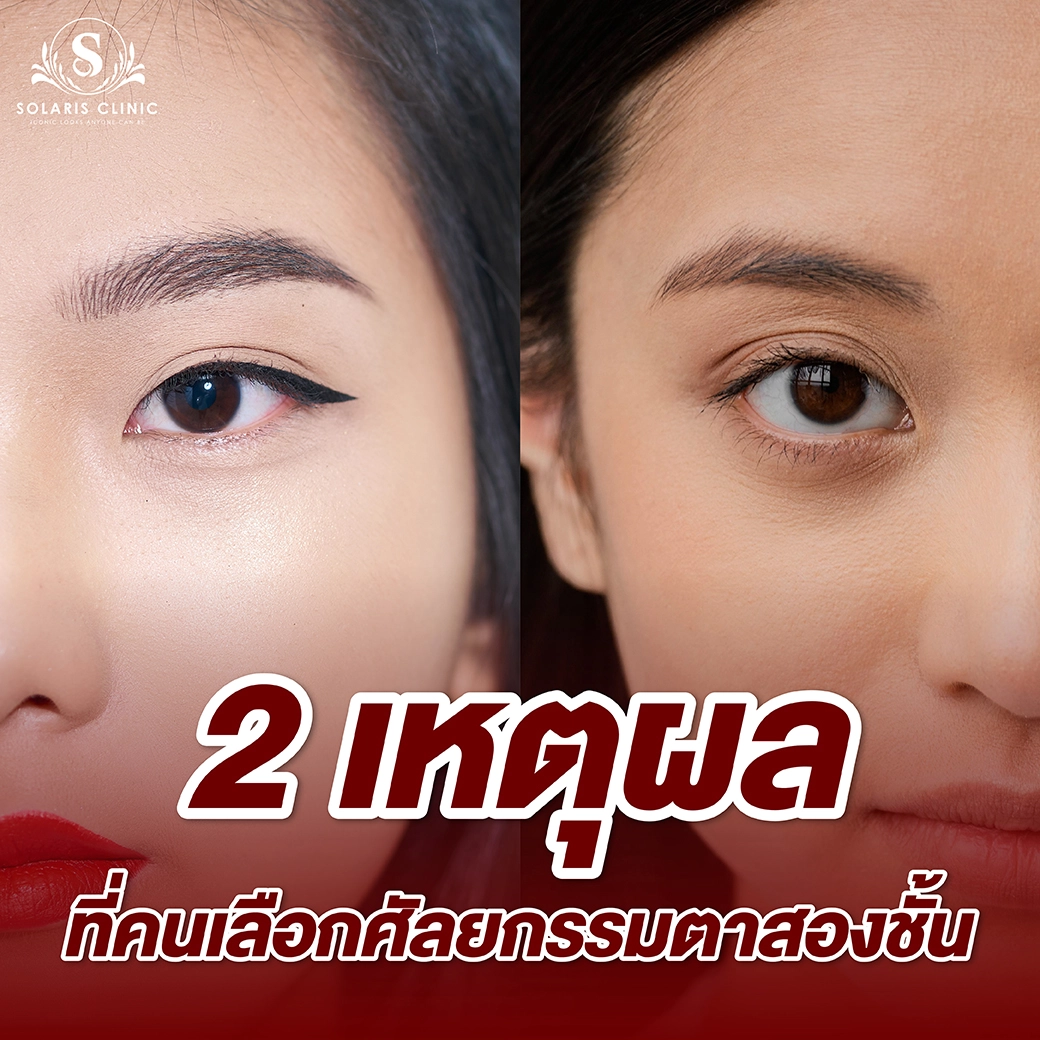 solaris clinic ตาสองชั้น