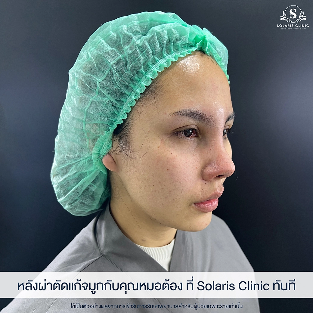 จมูกสวย คลินิก