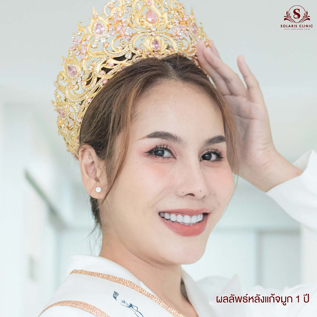 ทำจมูกที่ไหนดี กรุงเทพ