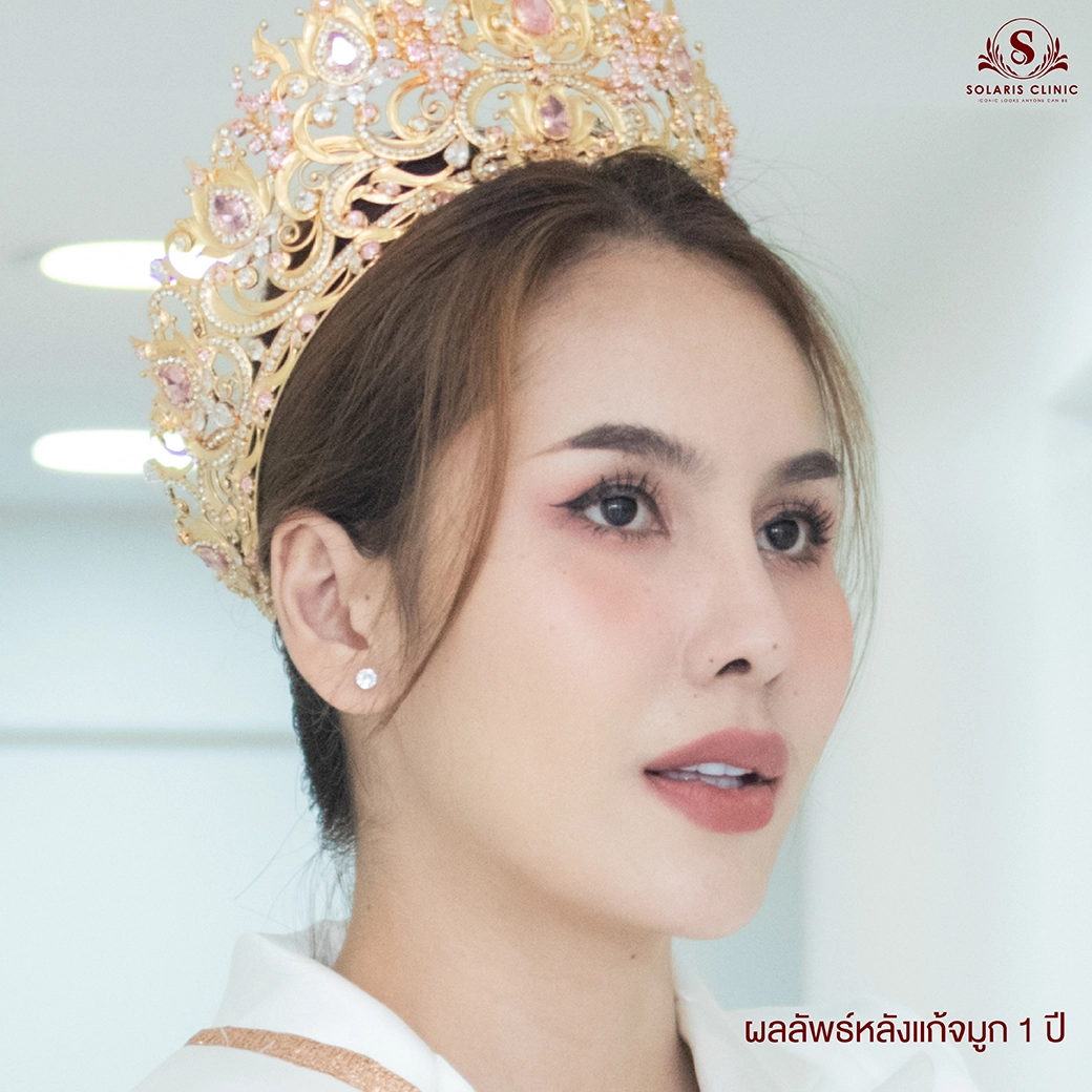 clinic ทำจมูกใกล้ฉัน