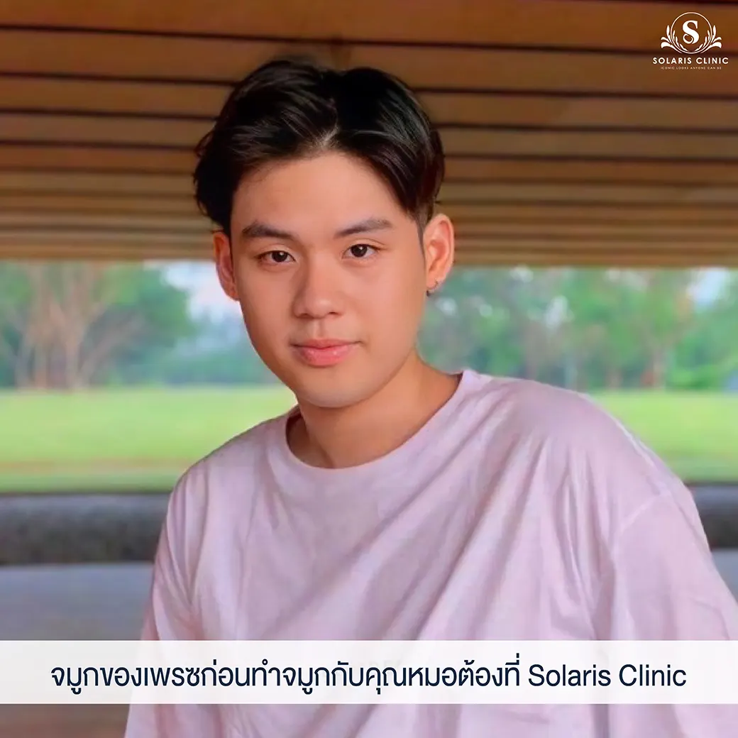 คลีนิกเสริมจมูกครั้งแรก ผู้ชาย