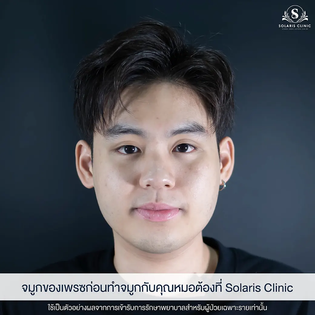 เสริมดั้ง โคราช ผู้ชาย