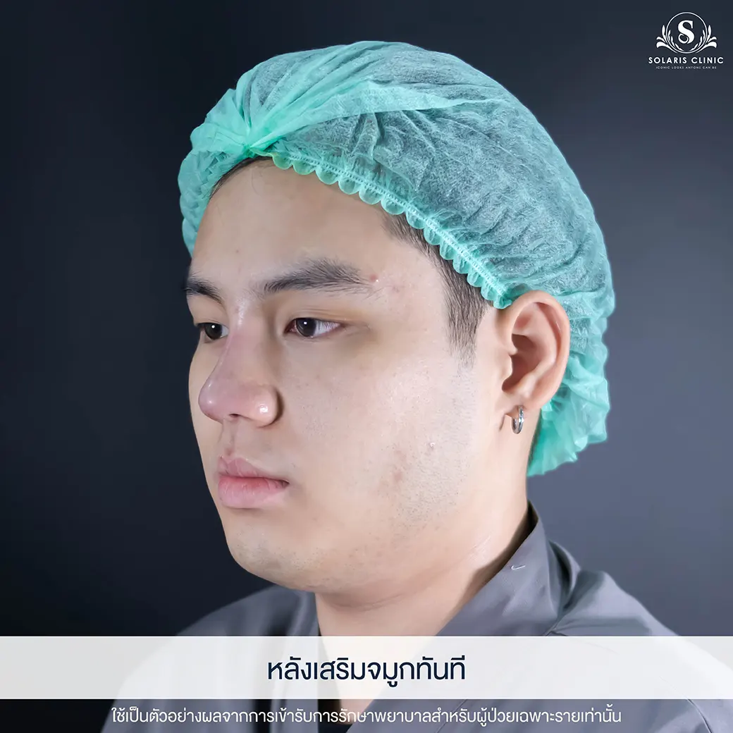 เสริมดั้ง ชลบุรี