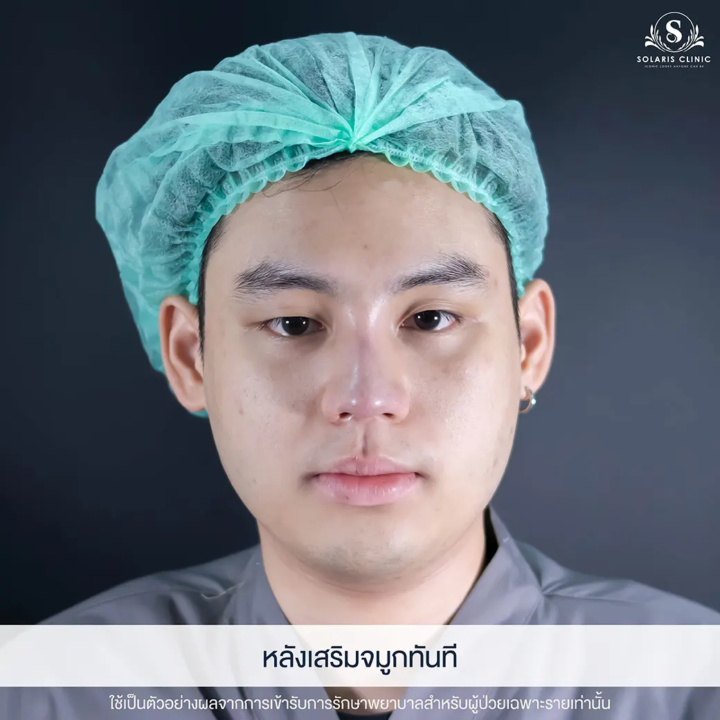 เสริมดั้ง โคราช ใกล้ฉัน