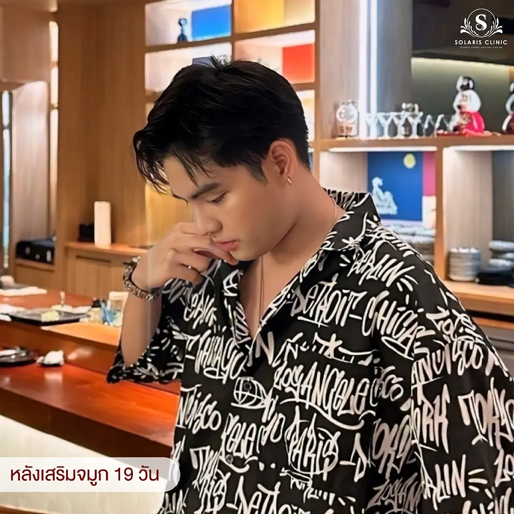 ทรงจมูกผู้ชาย ทรงสวยทำที่ไหน