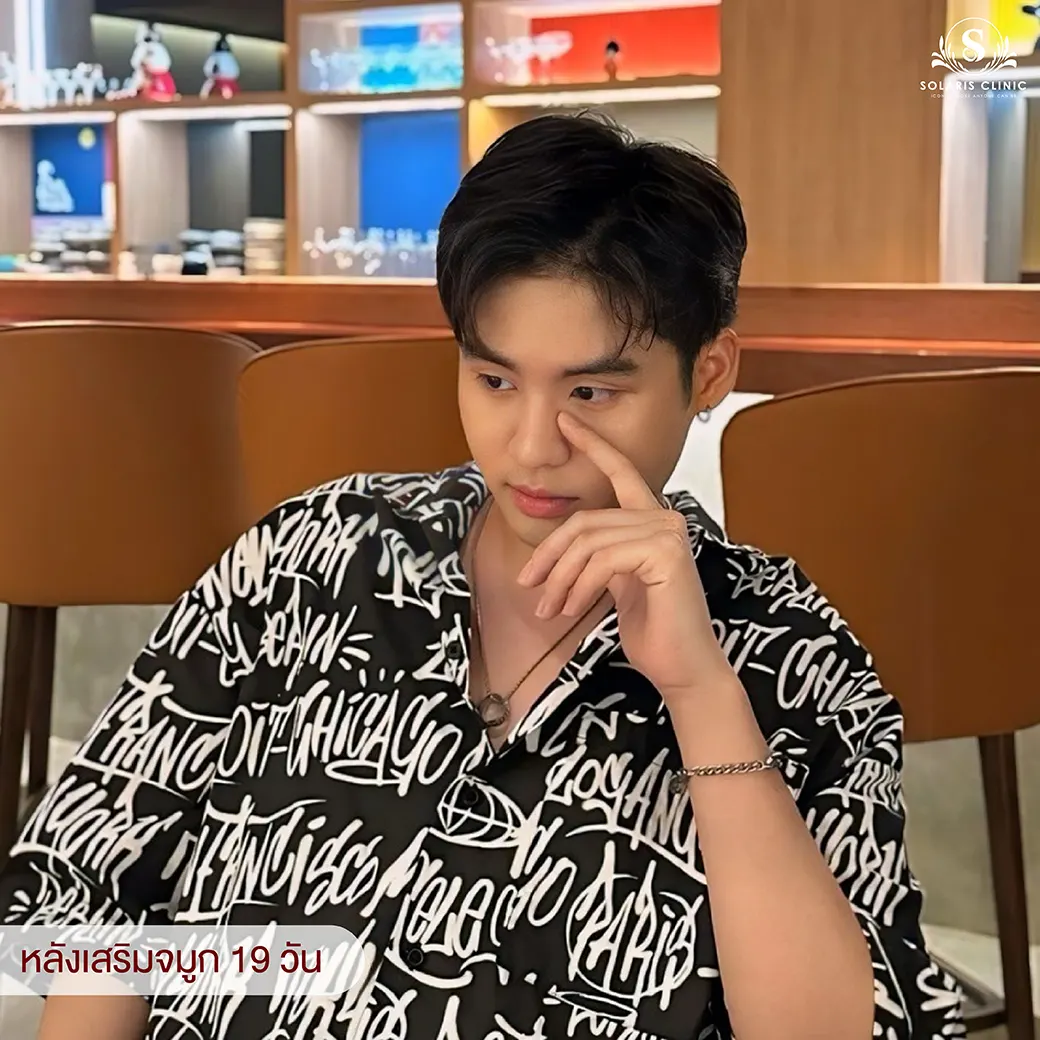 ทรงจมูกผู้ชาย ทรงสวยทำคลินิกไหน