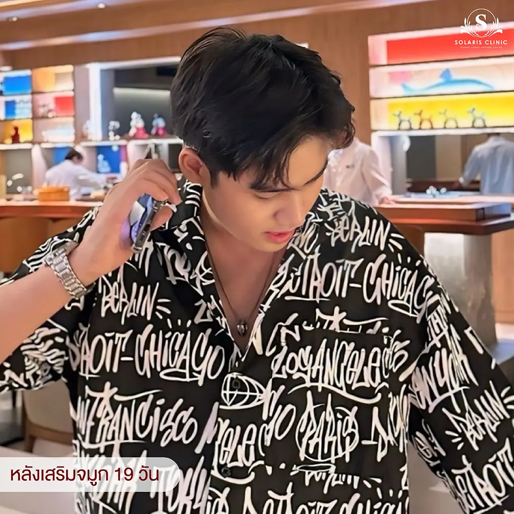 คลินิกเสริมจมูก ราคาไม่เกิน 10000