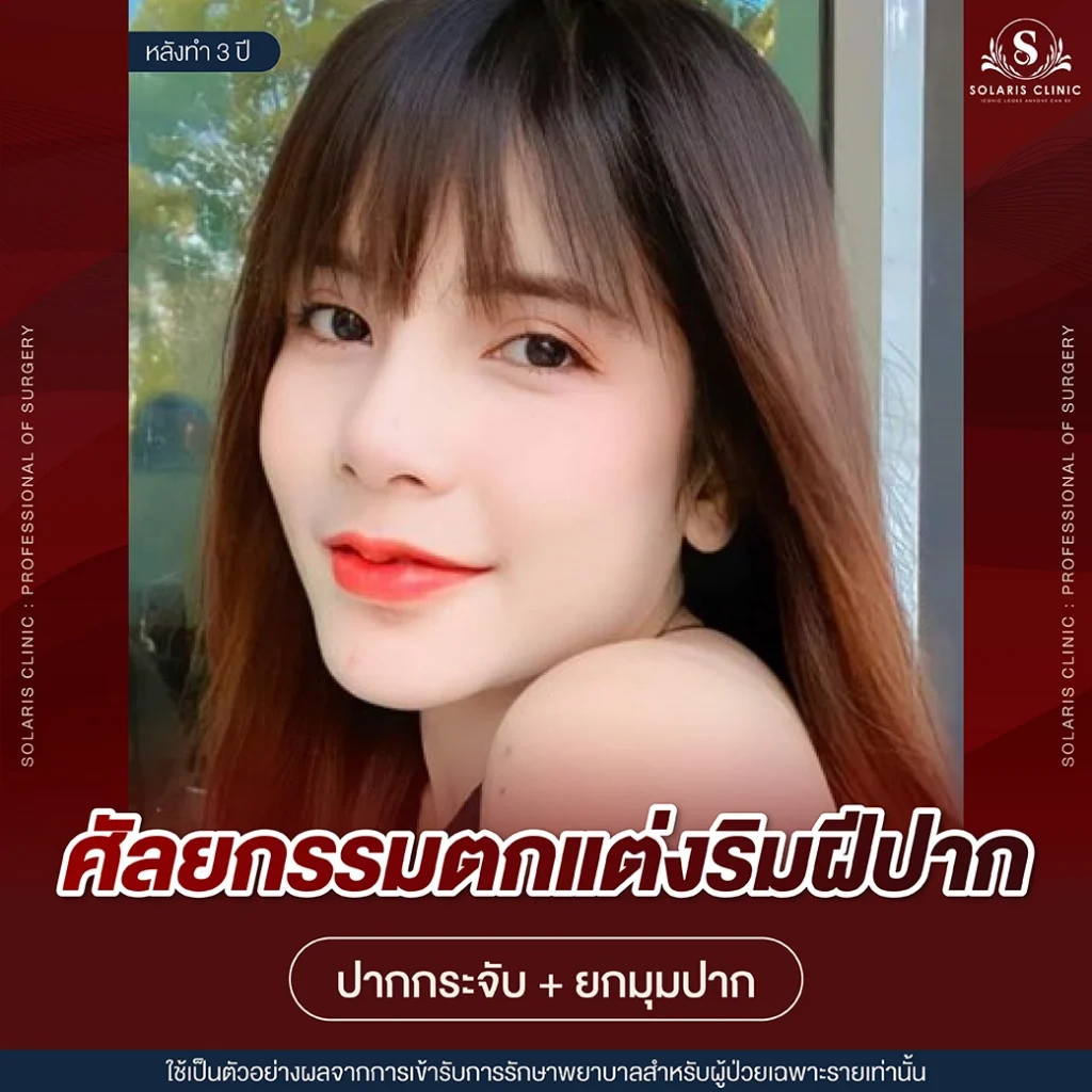 รีวิวปากกระจับ สไตล์เกาหลี