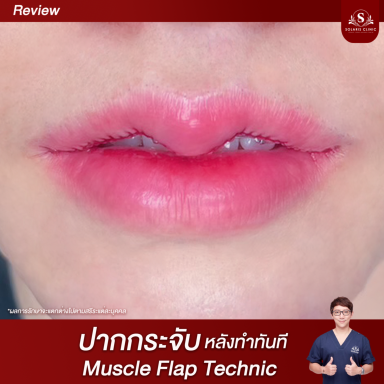 ปาก1