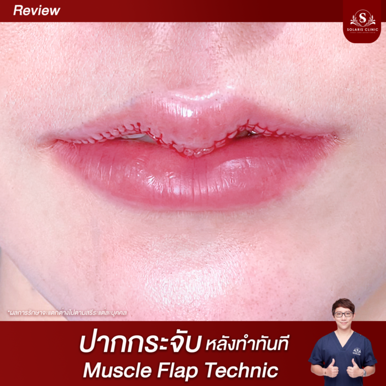 ปาก2