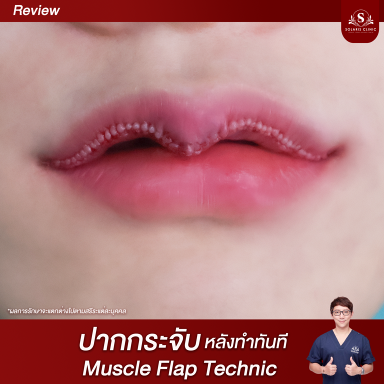 ปาก3