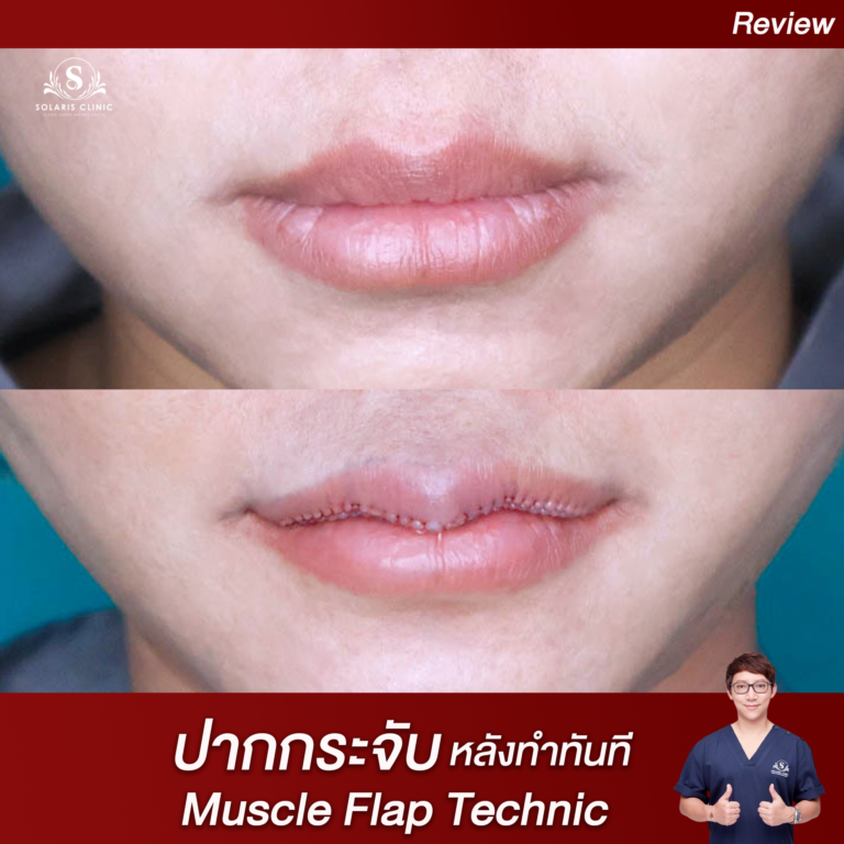 รีวิวปาก