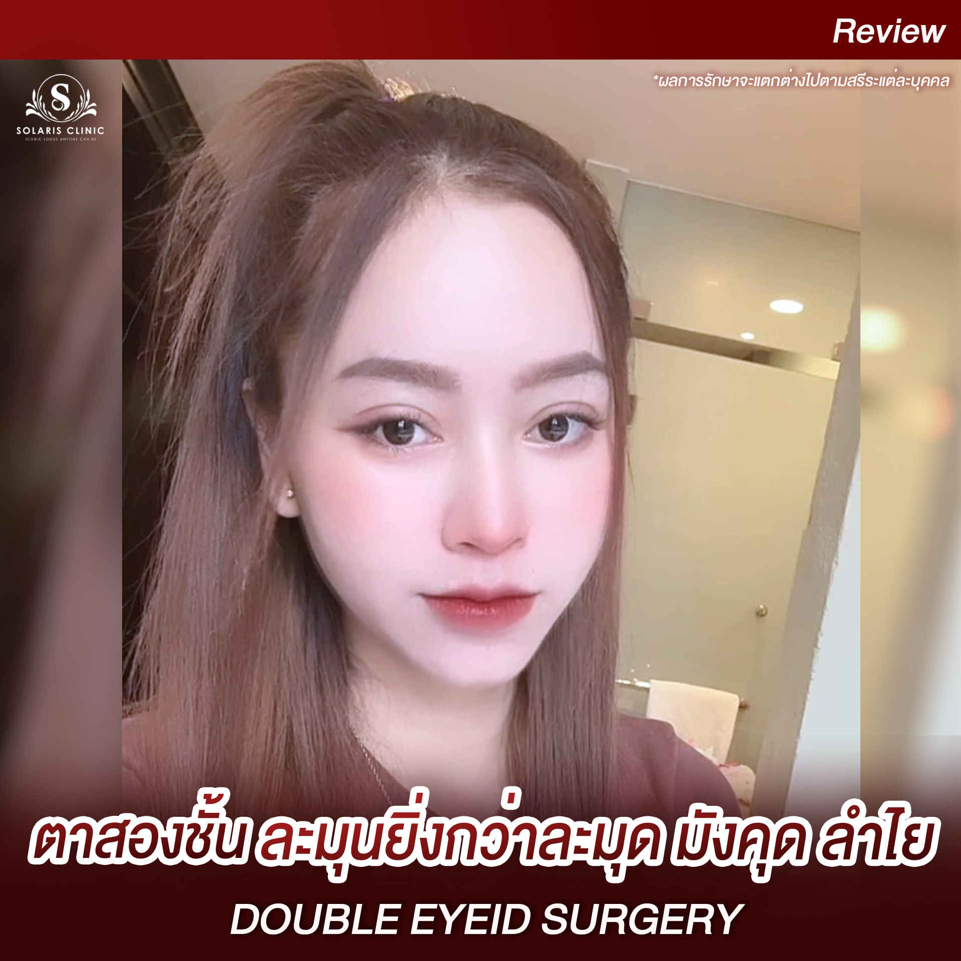 ละมุนยิ่งกว่าละมุดมังคุดลำไย