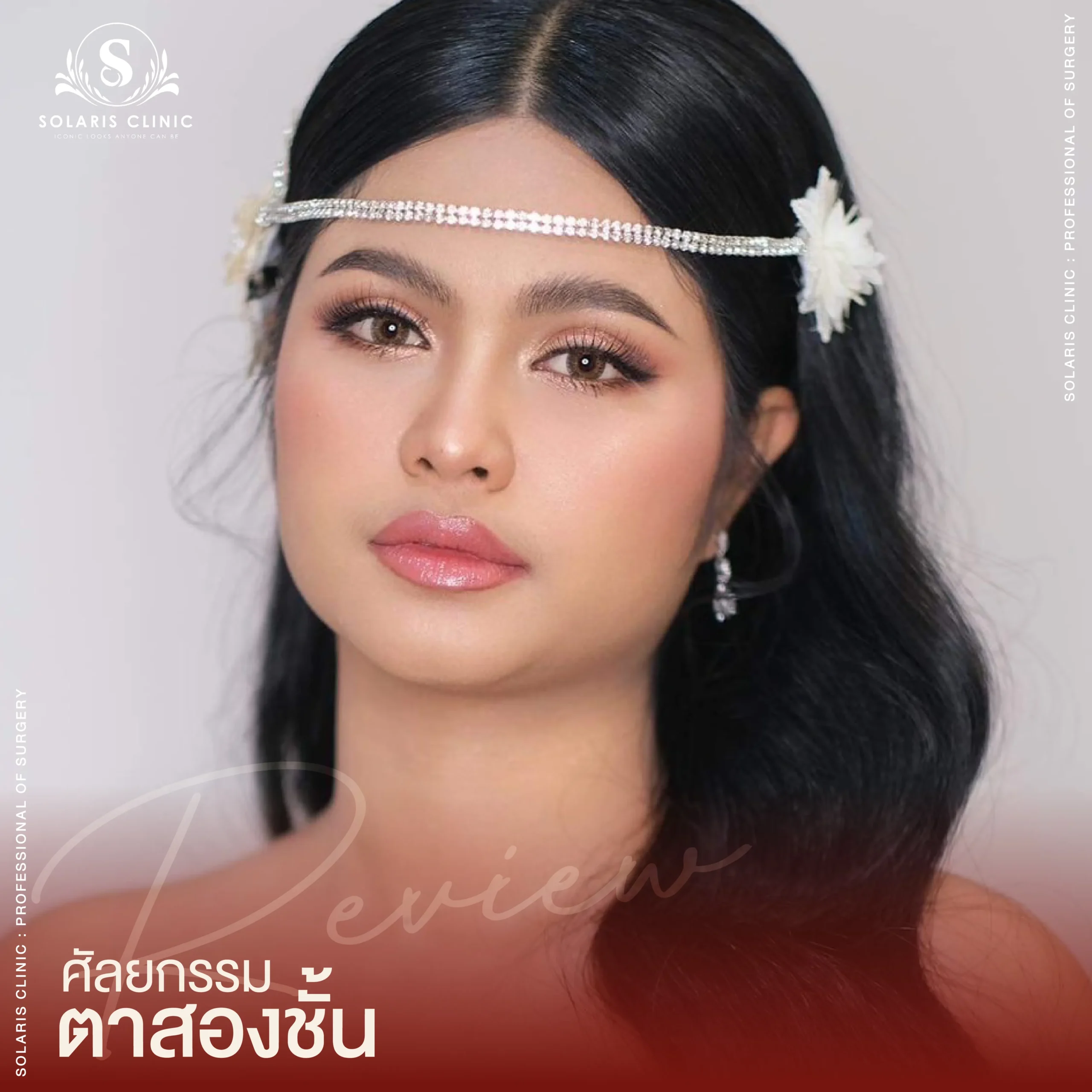 Review ศัลยกรรมตาสองชั้น-05_10