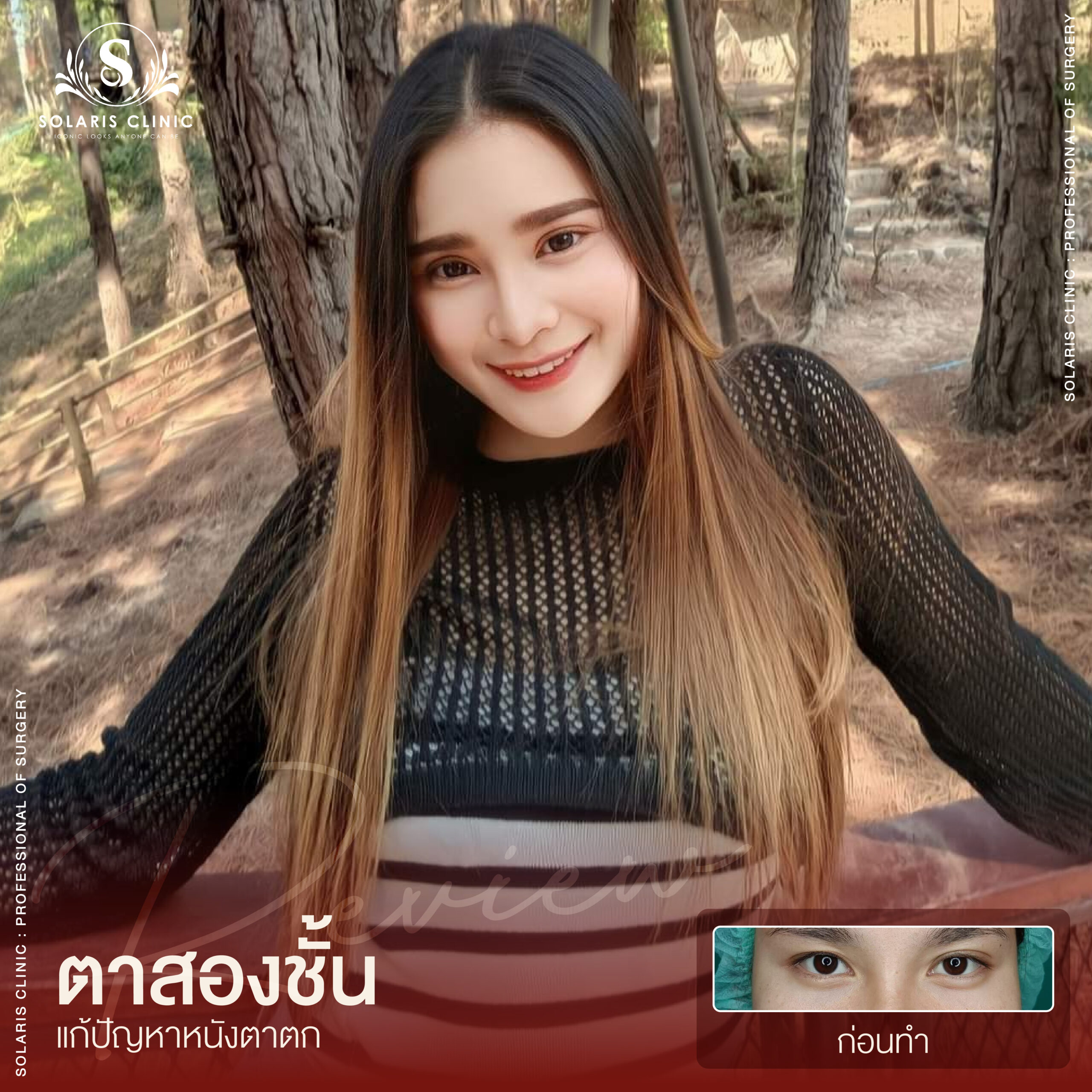 รีวิวหนังตาตก -01