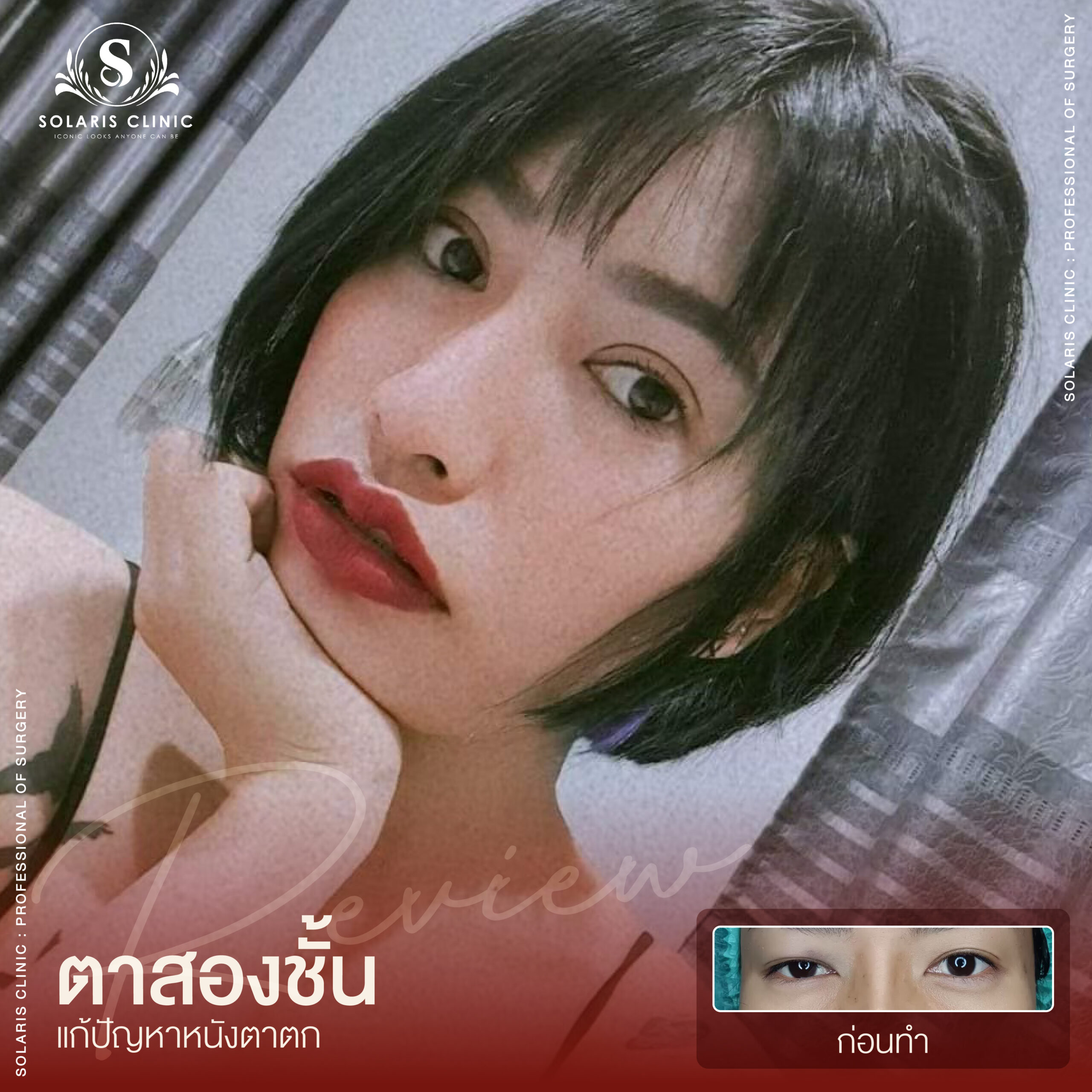 รีวิวหนังตาตก -02