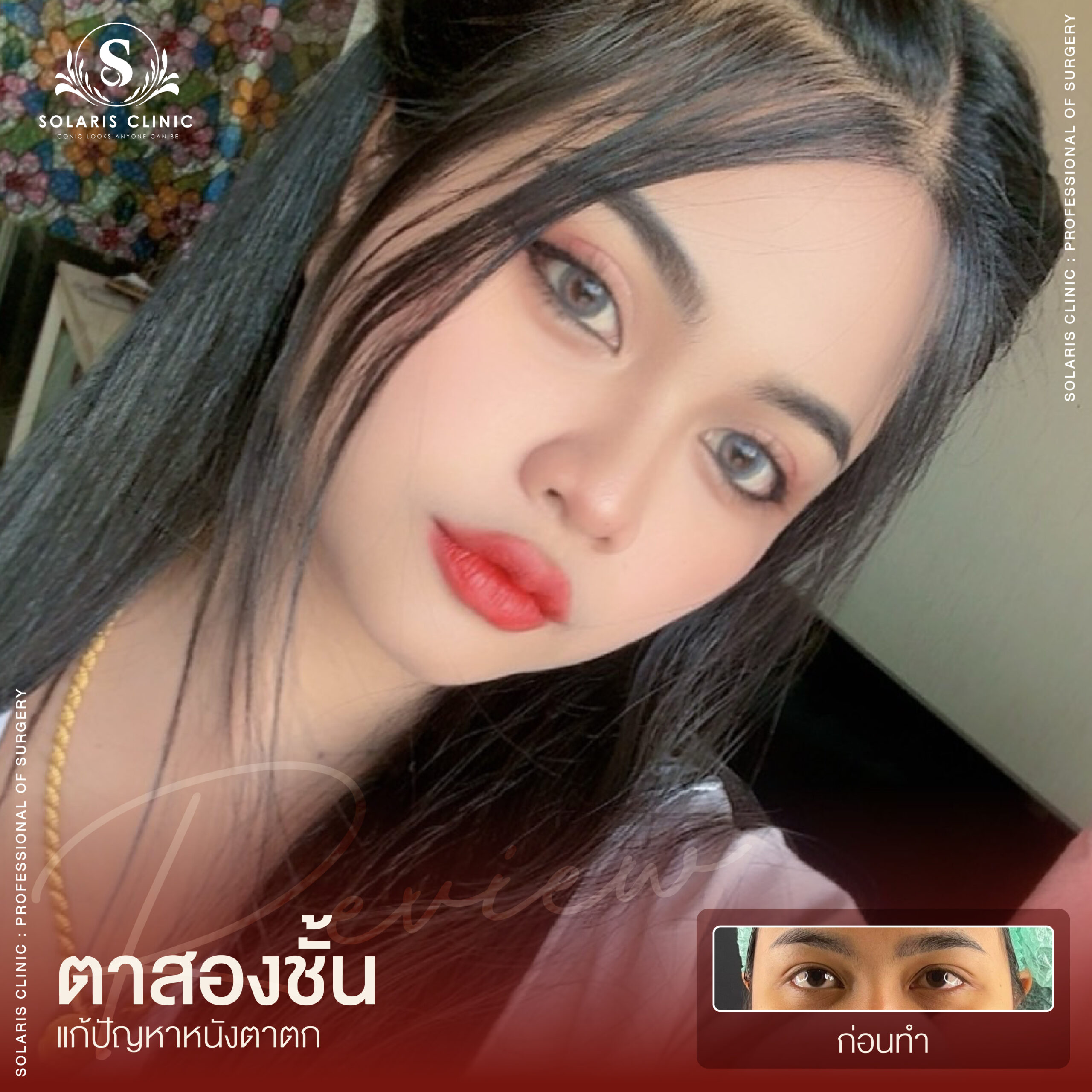 รีวิวหนังตาตก -09