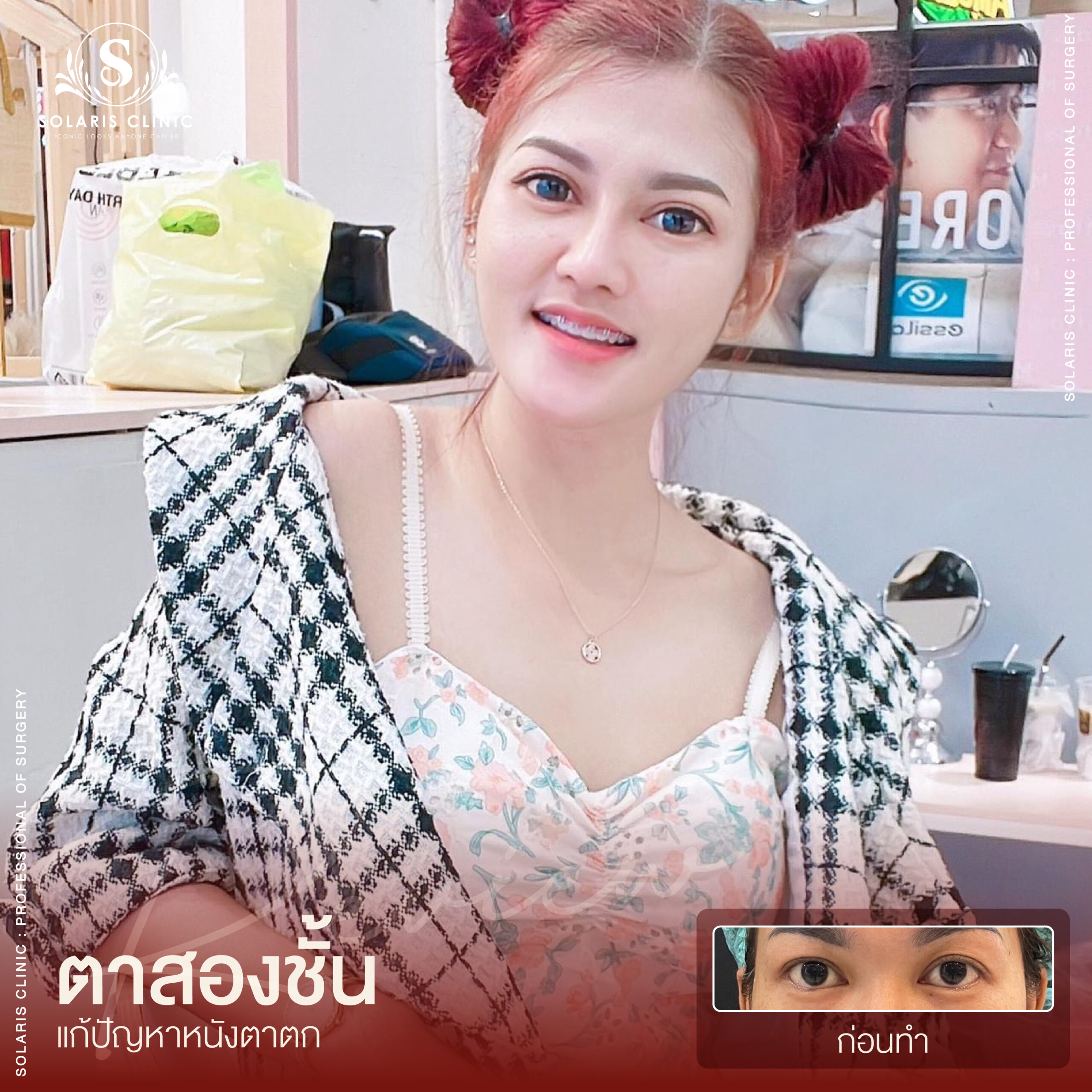 รีวิวหนังตาตก -10