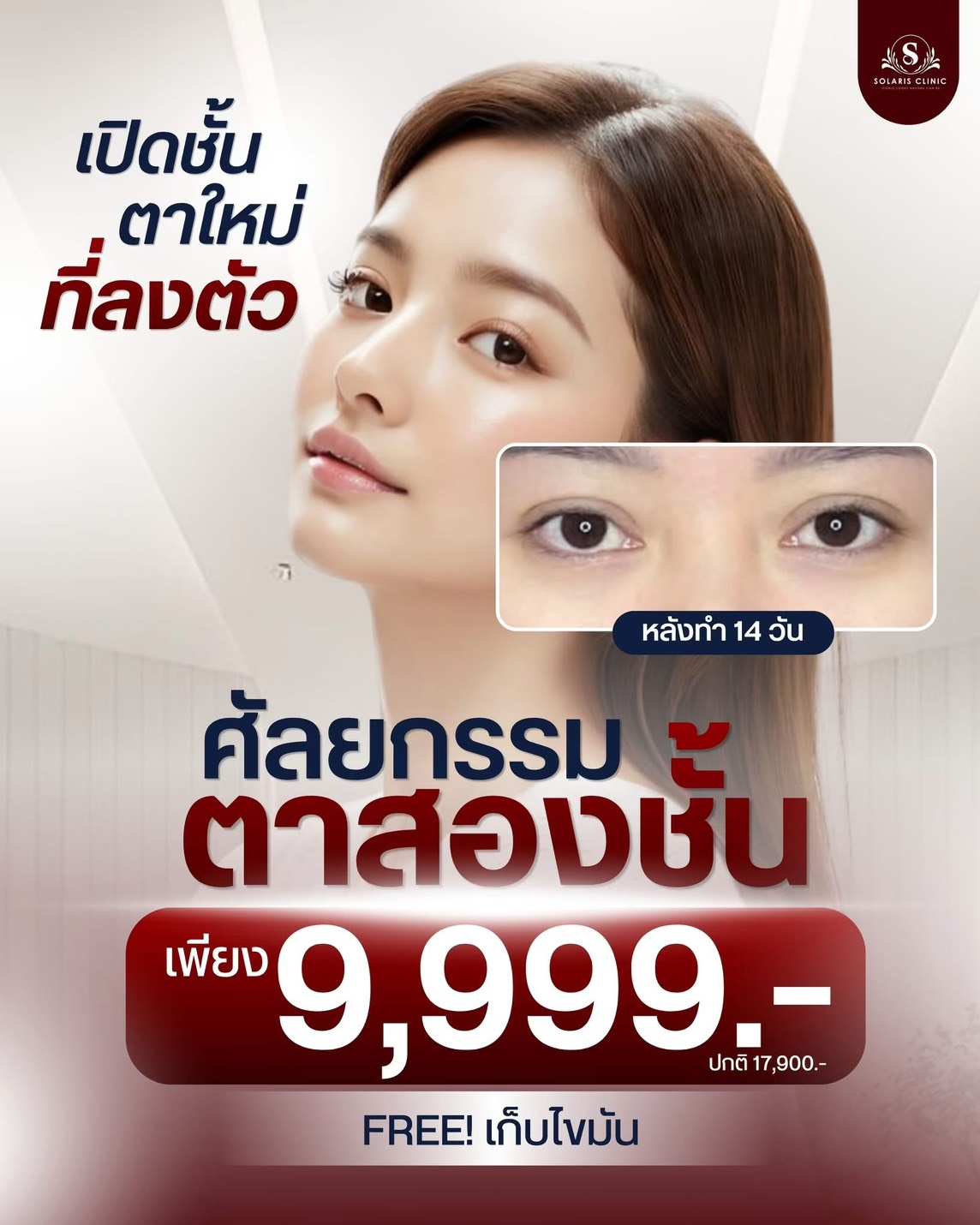 ศัลยกรรมตาสองชั้น