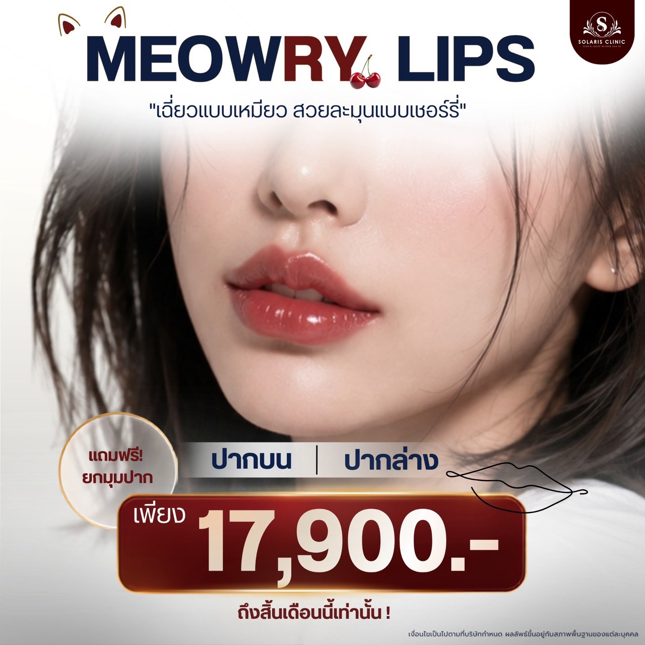 ปากกระจับ Meowry Lips (ปากบน + ปากล่าง)